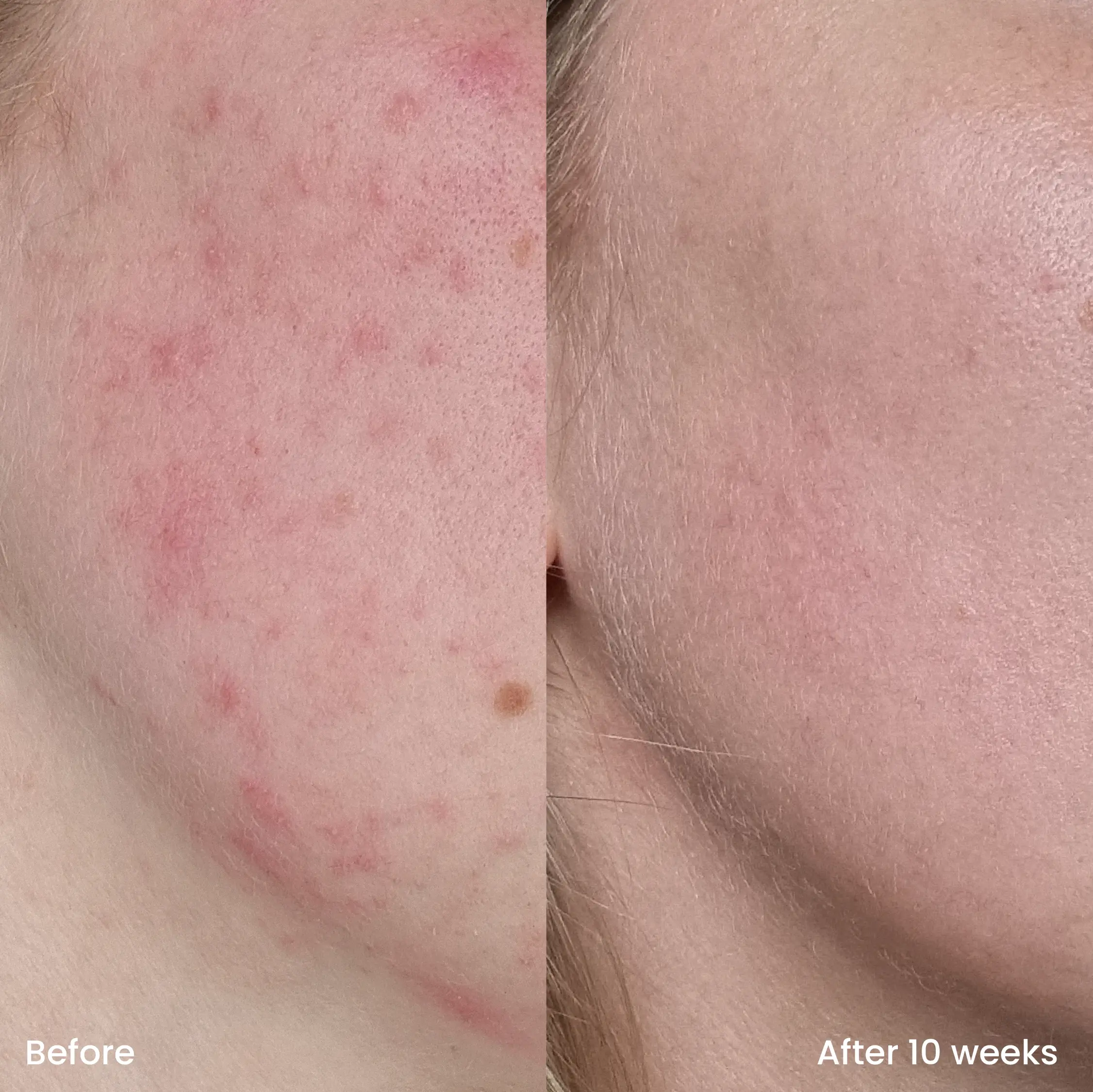Vitamin C Serum - Image 3